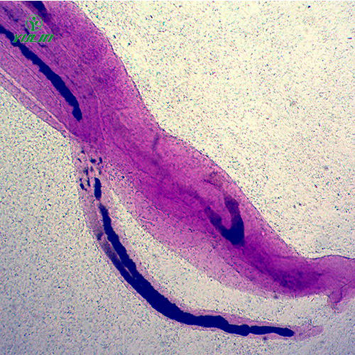 日本血吸蟲雌雄合抱裝片