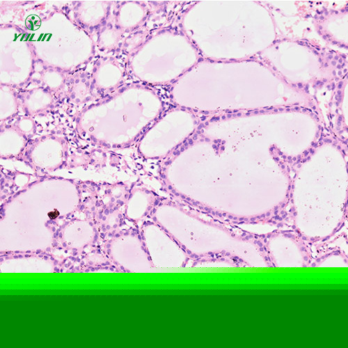 人內(nèi)分泌系統(tǒng)疾病標(biāo)本片