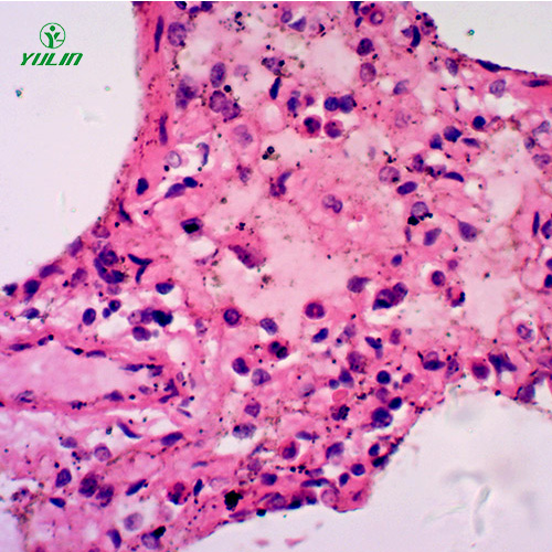 人呼吸系統(tǒng)疾病標(biāo)本片