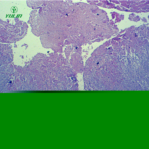 人體局部血液循環(huán)障礙病理玻片