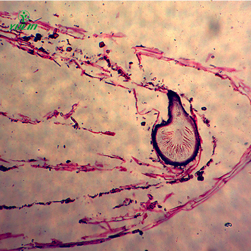 子囊菌植物病理玻片